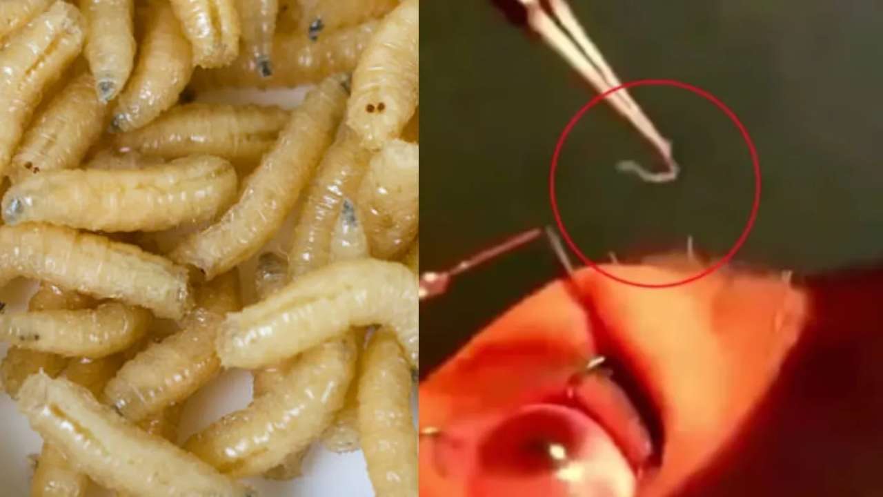 60 crawling insects were removed from a woman's eye, the doctor told the surprising reason