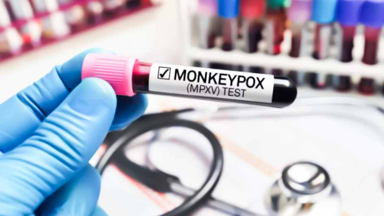 First indigenous RT-PCR kit made to deal with monkeypox