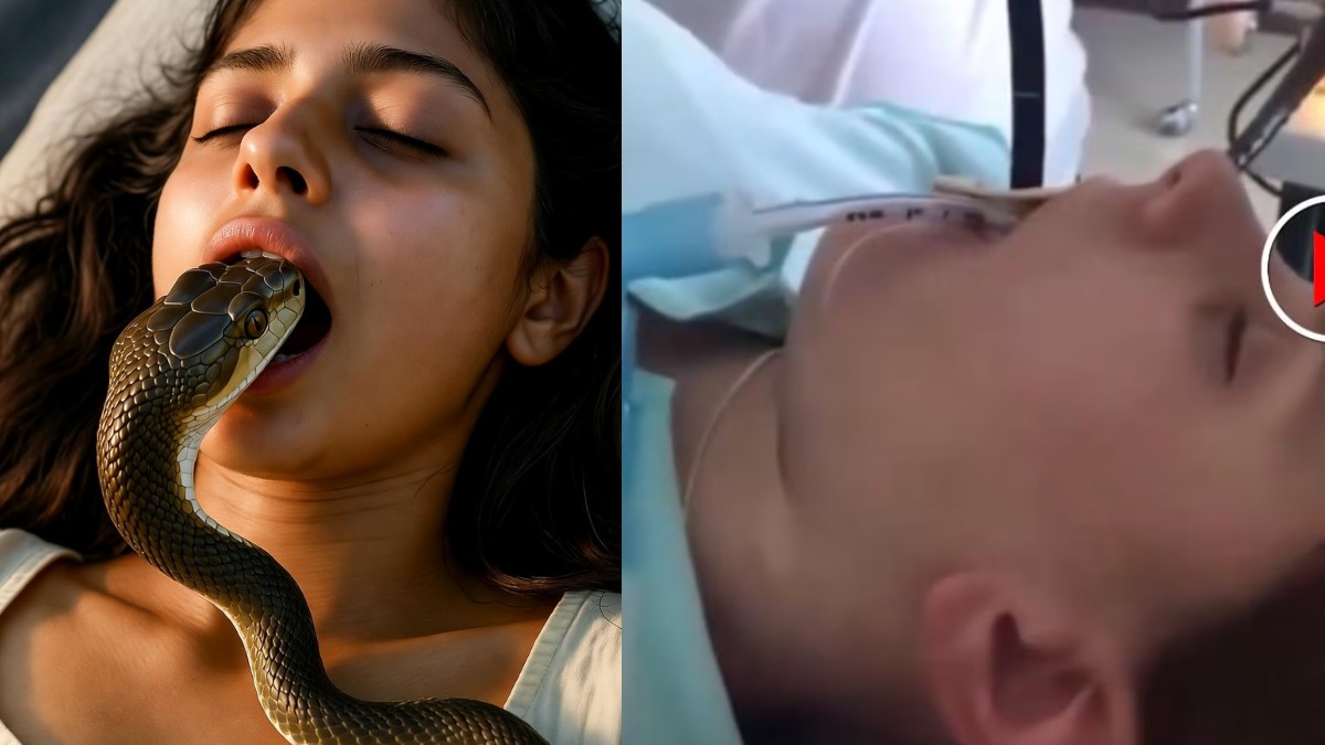 snake-entered-woman-mouth-while-she-was-sleeping Video viral