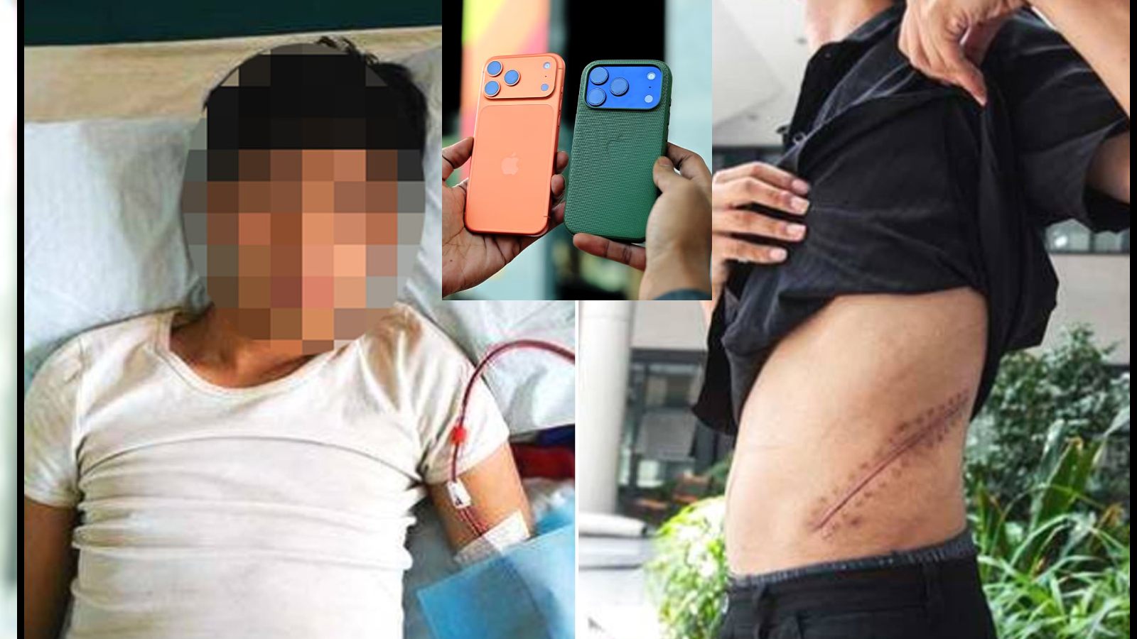 viral-man-sold-one-kidney-to-buy-iphone