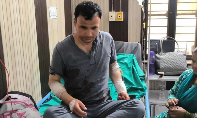 champawat-teacher-wife-attacks-husband-with-sharp-weapon-in-lohaghat