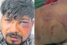 dehradun-youth-brutally-assaulted