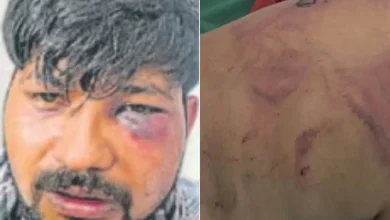 dehradun-youth-brutally-assaulted