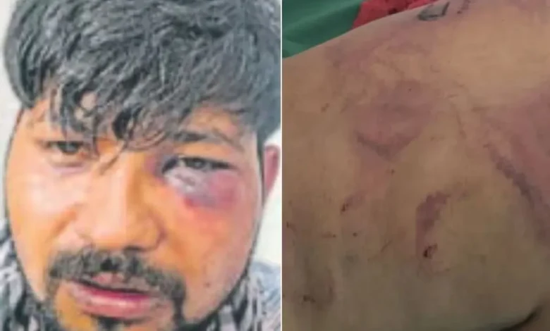 dehradun-youth-brutally-assaulted