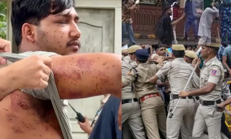 delhi-raf-fire-pellet-gun-in-jantar-mantar-protest-cjp-parliament